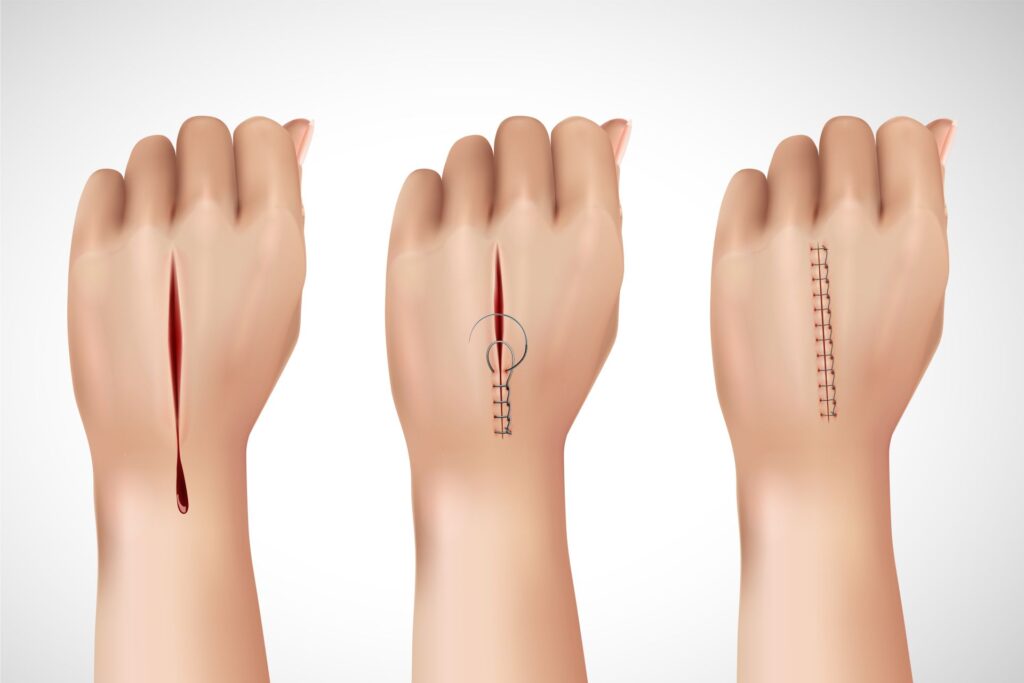 Hand surgery consultation at HESS in Lahore