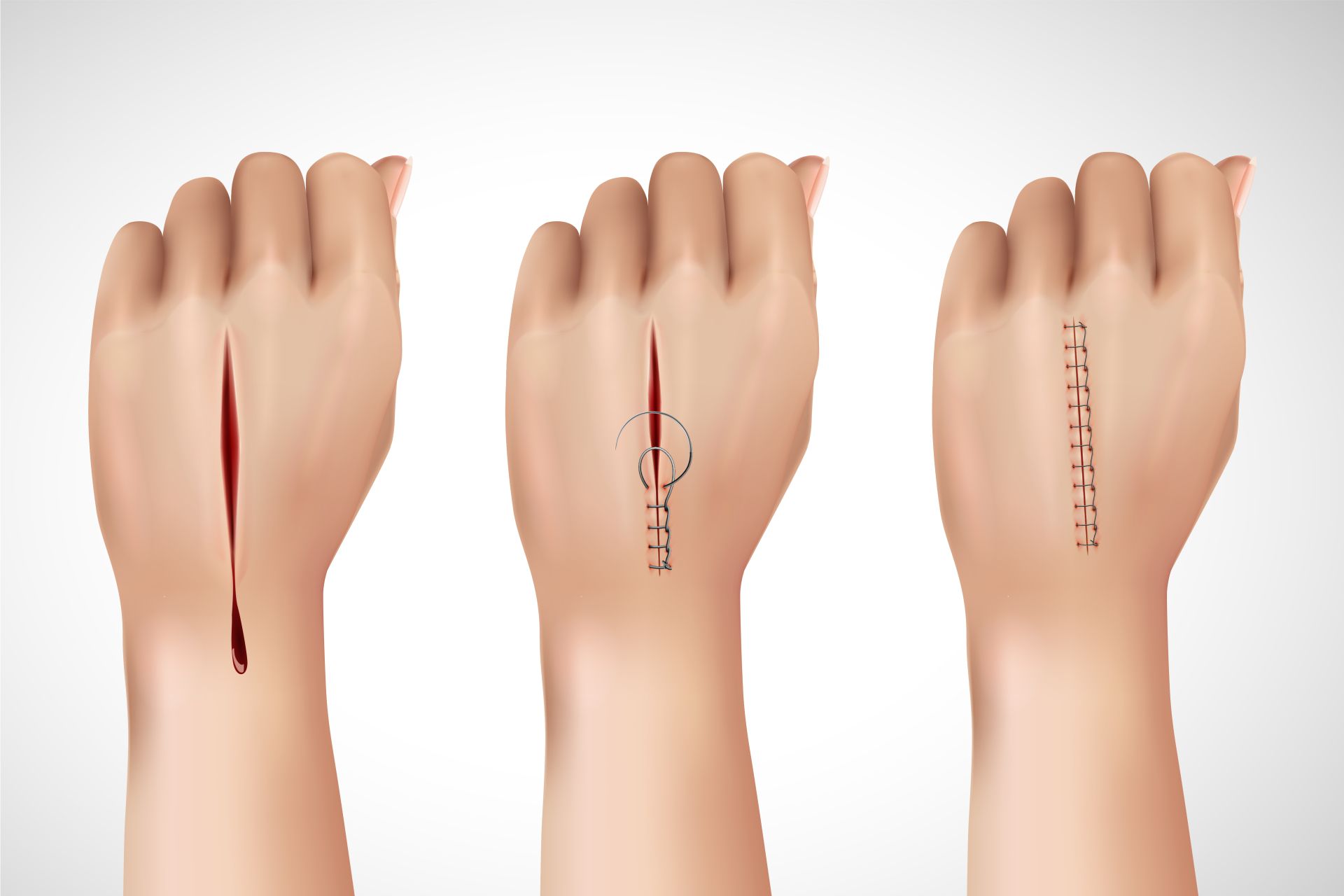 Hand surgery consultation at HESS in Lahore